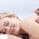 Acupuncture-the-Traditional-Chinese-Medicine